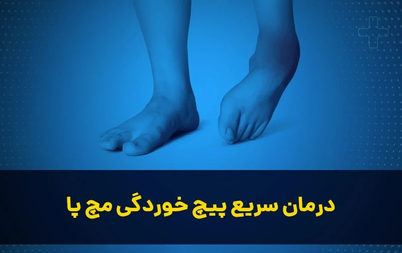 سریع ترین درمان پیچ خوردگی مچ پا و پا تنها با چند حرکت
