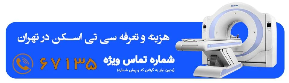 چه زمانی سی تی اسکن سر تجویز می شود؟