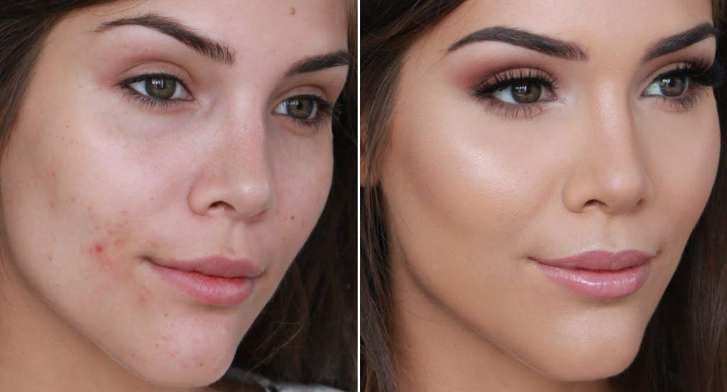 غذاهای مفید برای پوست با طب سنتی؛ راه حل طبیعی