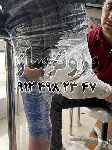 نگاهی به دنیای پروتز پا